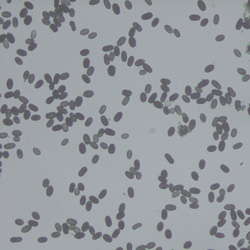 Stachybotrys spores