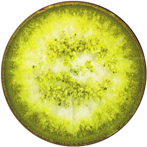 Aspergillus
