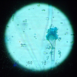 Aspergillus fumigatus microscope