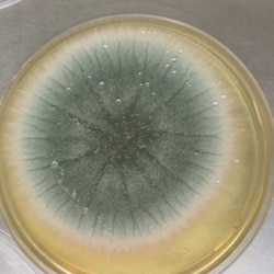 Aspergillus fumigatus