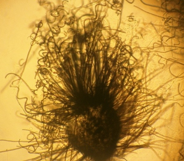 chaetomium globosum ascoma