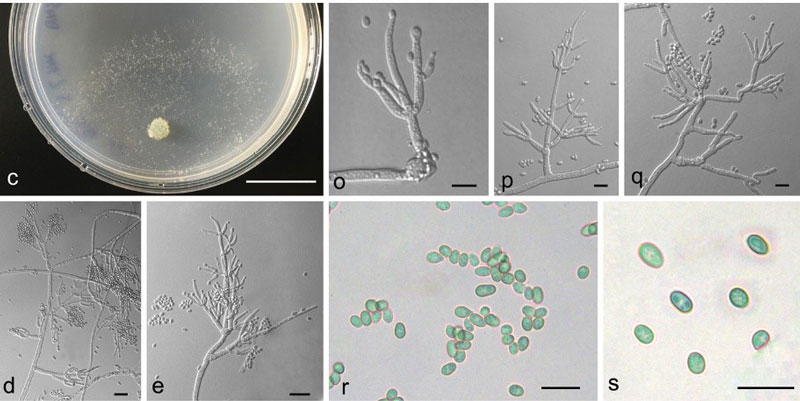 culture and micromorphology of trichoderma fujianense 2