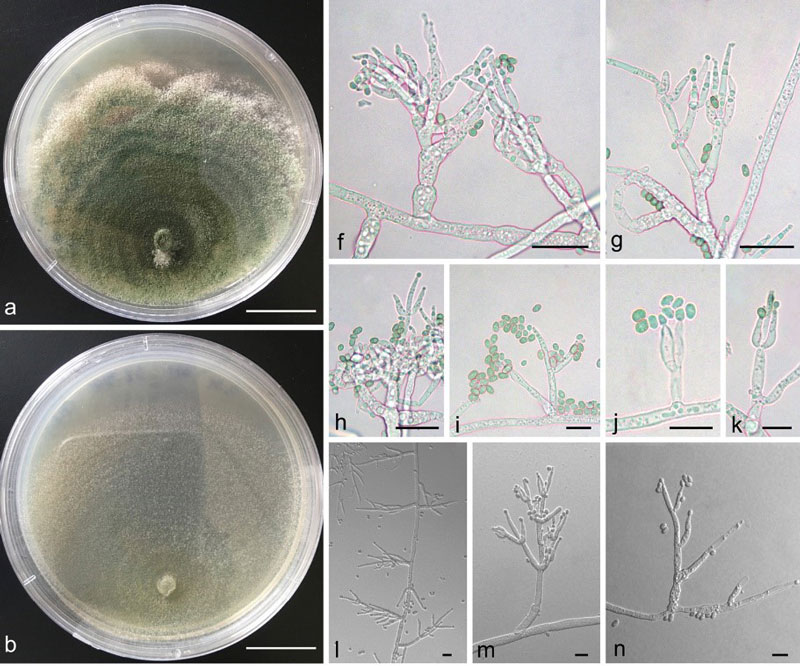 culture and micromorphology of trichoderma fujianense