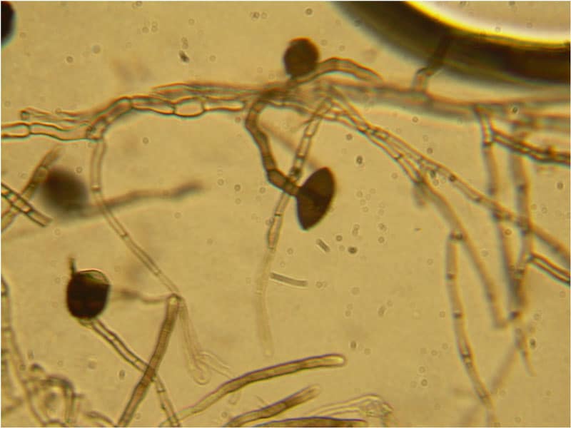 ulocladium conidiophores