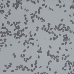 stachybotrys sp spores