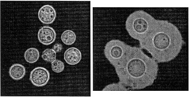 Cryptococcus gattii