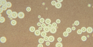 Cryptococcus neoformans