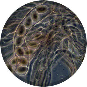 Ascospores