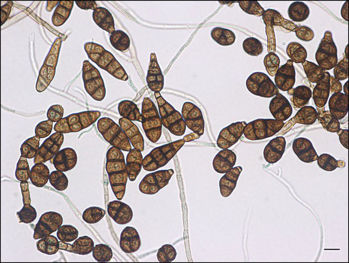 alternaria alternata conidia