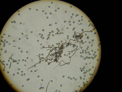 Chaetonium (Acremonium) ascospores