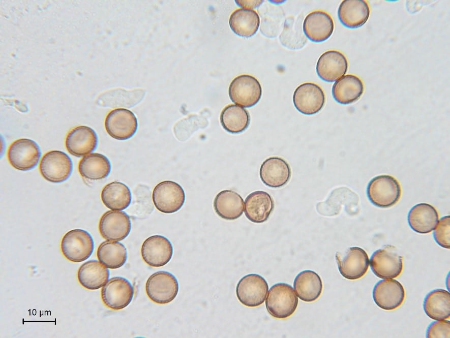 Spores of Symphytocarpus flaccidus