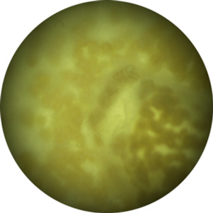 Phoma