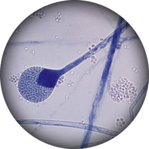 Absidia