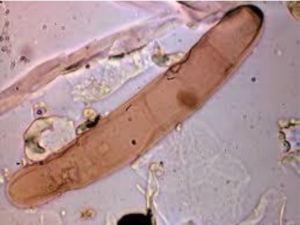 Drechslera spores under the microscope