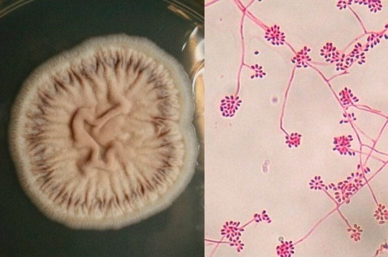 Culture of Sporothrix schenckii (left) and filamentous state with thin hyphae and conidia (right)