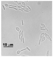 Micrograph of the yeast form of Sporothrix schenckii