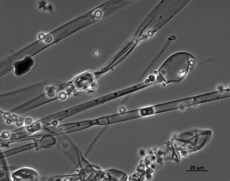 Mycelia of Mucor racemosus