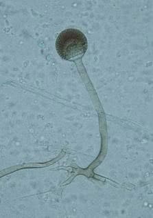 Rhizopus microspores sporangia