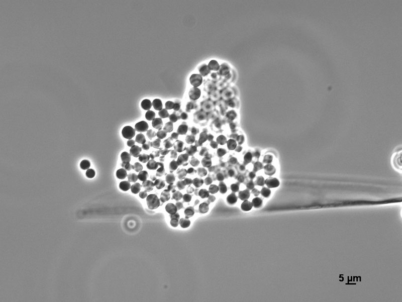 Sporangiospores of Mucor racemosus