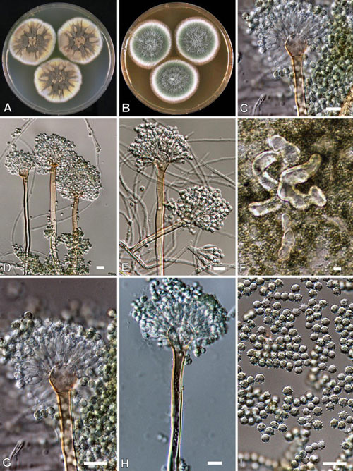 Aspergillus ustus colonies and condiophores