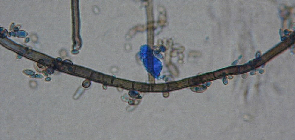 Aureobasidium pullulans fig 1