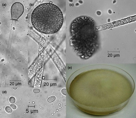 Morphology of Mucor hiemalis