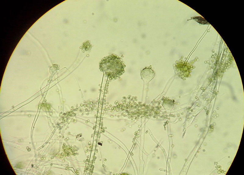 fungi Aspergillus oryzae under light microscope