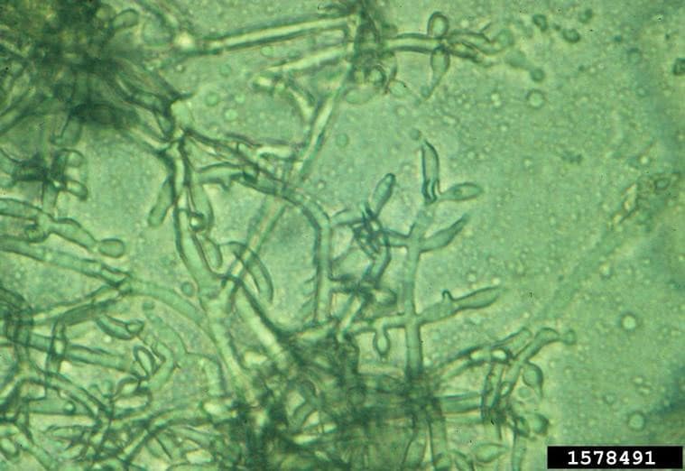 trichoderma viride under the microscope