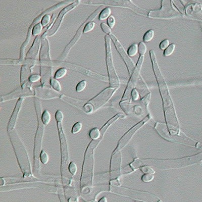 Paecilomyces variotii under the light microscope