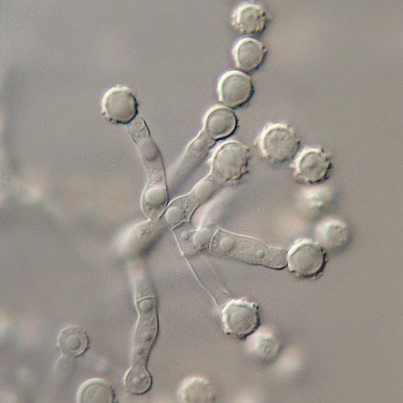 scopulariopsis brevicaulis conidia