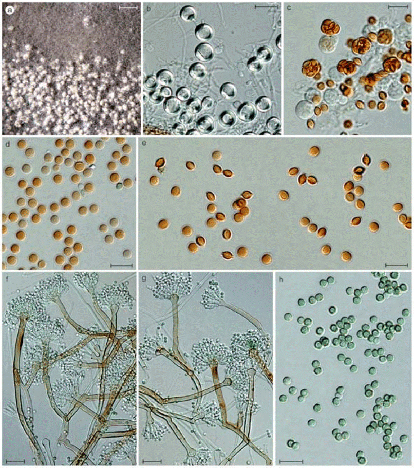 Aspergillus nidulans var nidulans a e Teleomorph and f h Anamorph a Ascomata surrounded by hulle cells and conidial heads b Hulle cells c Asci d e Ascospores f g Conidiophores h Conidia