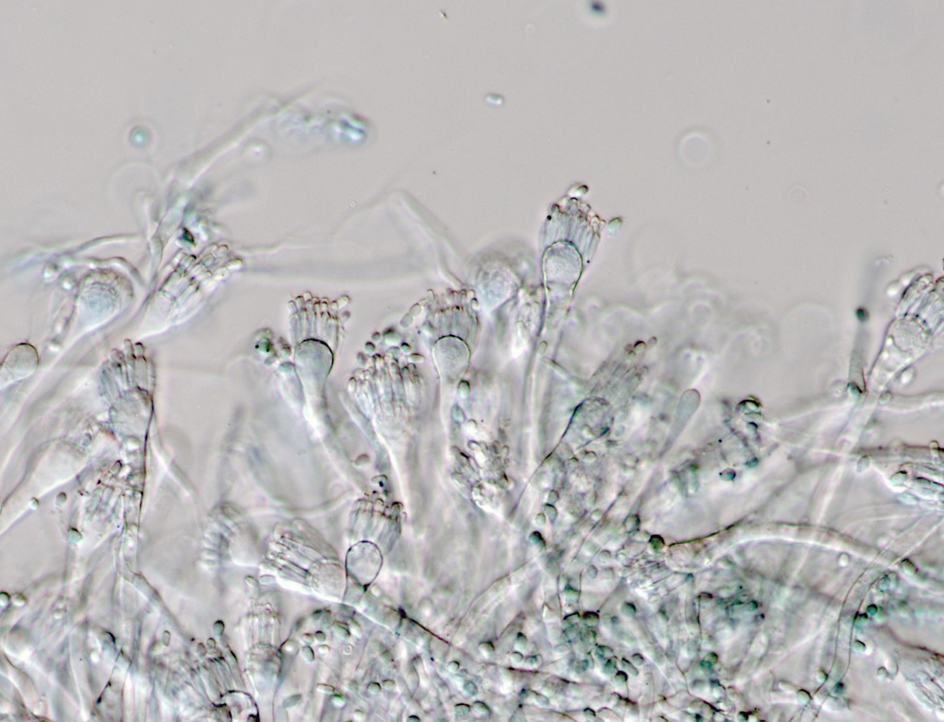 Aspergillus restrictus conidiophores