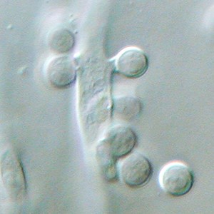 Aspergillus terreus aleurioconidia