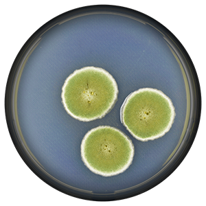 Aspergillus unguis colonies