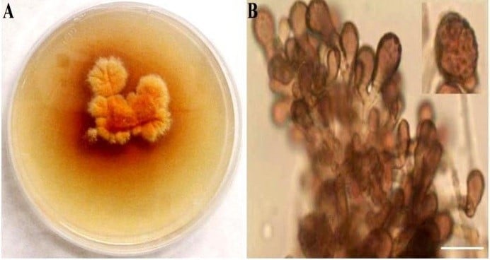 Epicoccum nigrum (A) 10 days old culture on PDA medium (B) Microscopic features showing conidia and conidiophores