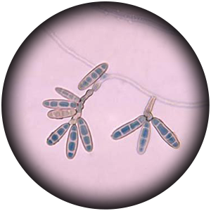 loc de frunze helminthosporium)
