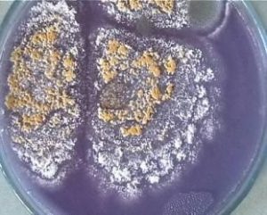 Malbranchea cinnamomea colonies