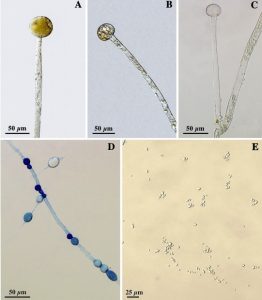 Mucor indicus A. Unbrached sporangiophore with sporangia B Sporangiophore with columella C Sporangiophore branch with columellap D Chlamydospores E Sporangiospores