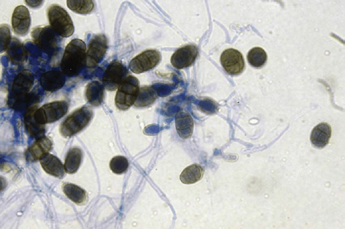 Pithomyces conidia with cross septal walls