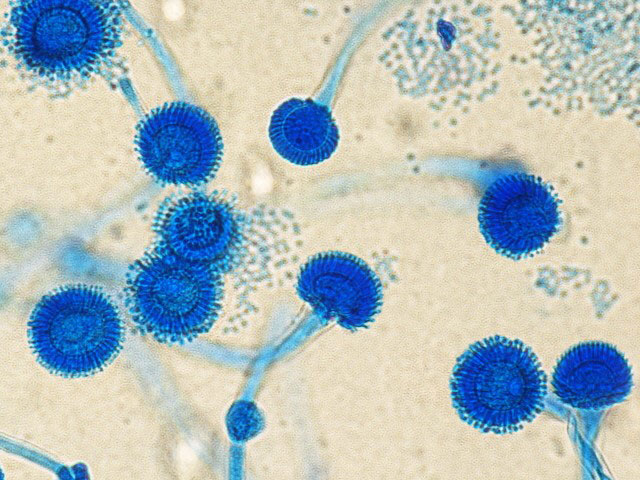 figure 2. aspergillus fumigatus under the microscope