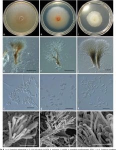 Graphium species colonies (a), synnema (b), and conidia (c,d)