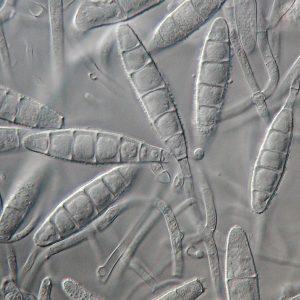 Macroconidia of Microsporum gypseum