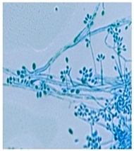 Sporothrix schenckii conidia