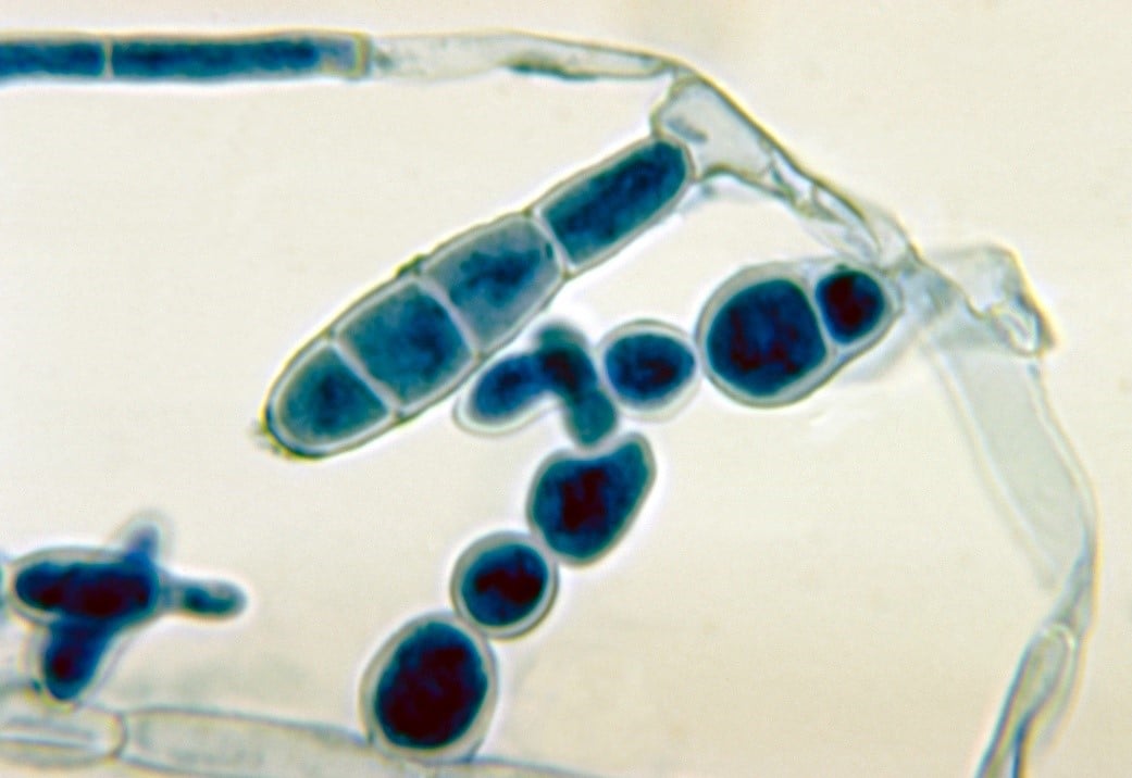 Macroconidia of the dermatophyte Epidermophyton floccosum