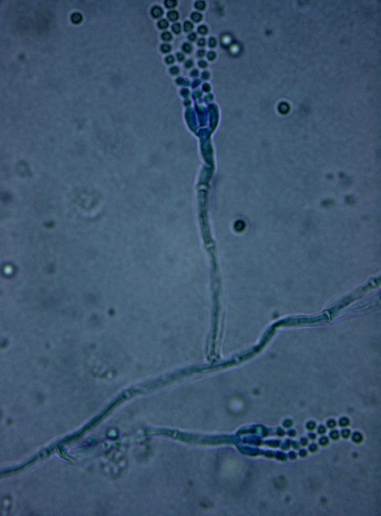 Conidiophores of Penicillium camemberti with conidia