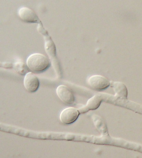 Environment sample of Scedosporium prolificans cultured on Leonian's agar