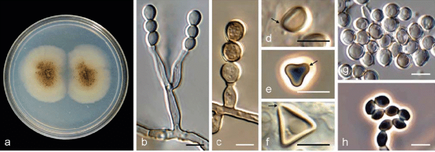Morphological features of Microascus spp. Colony on Plate Count Agar (a), conidiogenous cells (b c), ascospores (d f), conidia (g h) Image source Sandoval Denis et al. (2016)