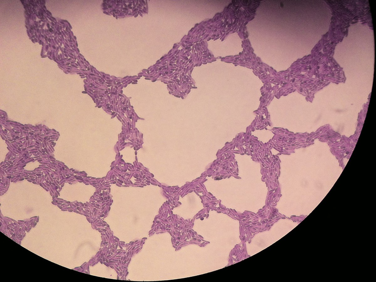 Rhodotorula mucilaginosa cells