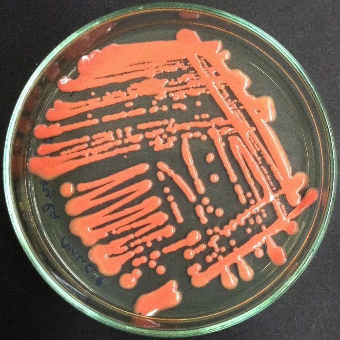 Rhodotorula mucilaginosa colonies