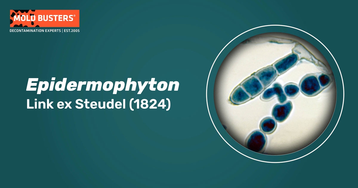 Epidermophyton Epidermophyton